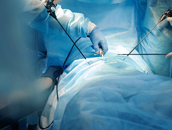 Umbilical Hernia-img